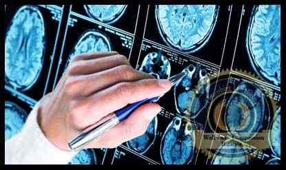 A doctor examining brain scans. An article on organic mental disorders